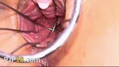 Play Gap her gyno hole out real severely